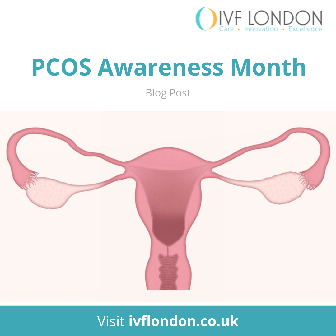 PCOS Polycystic Ovary Syndrome: symptoms, infertility and treatment