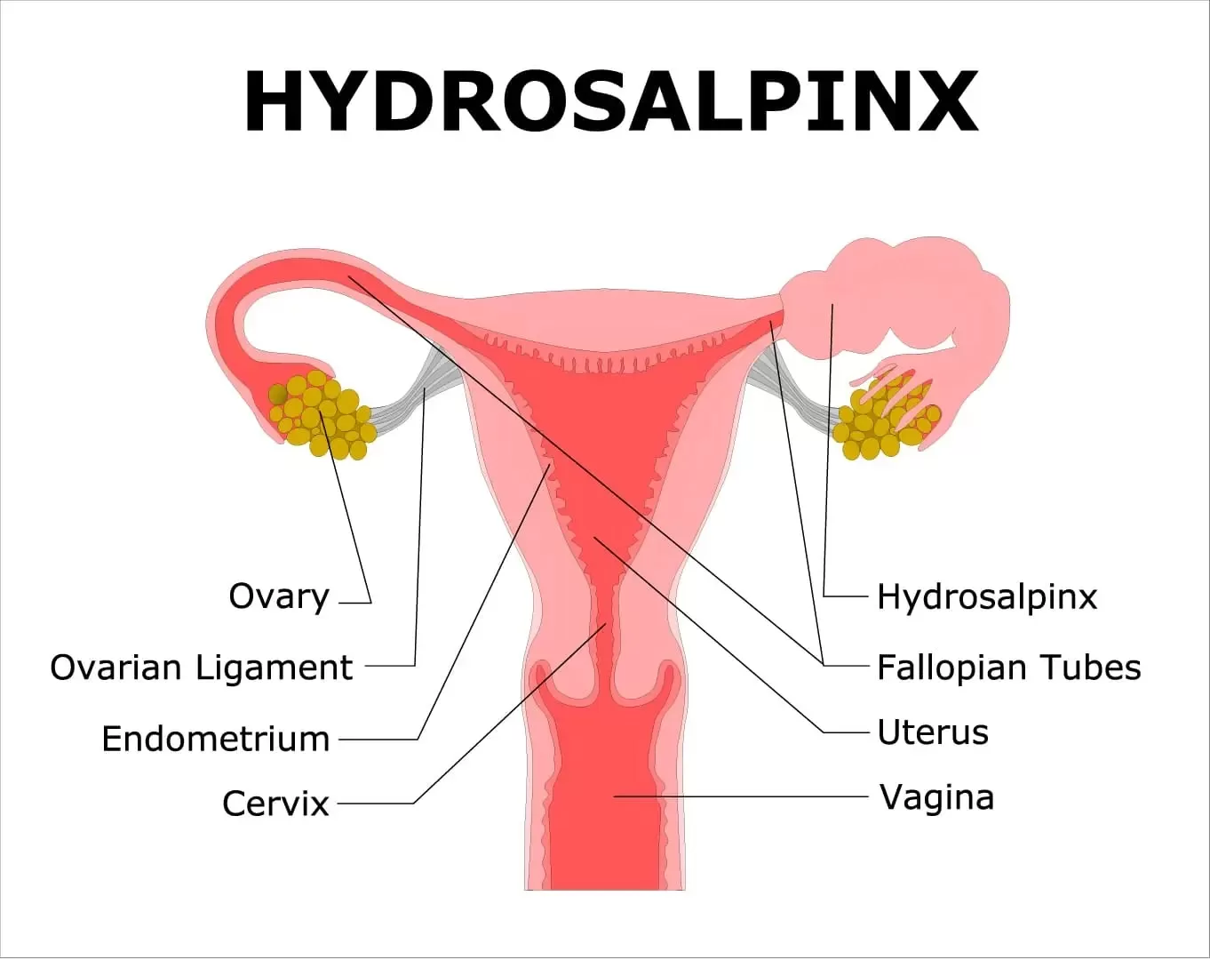 Emotional Support During IVF: Coping Strategies for Couples
