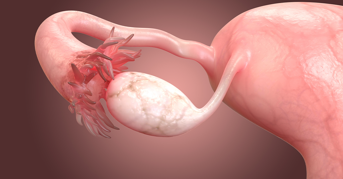 Poor Egg Quality: Symptoms & Treatment for Immature Eggs